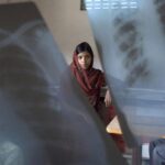 Tuberculosis: An ancient killer we can't seem to defeat
