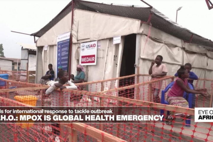 Mpox is global health emergency