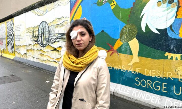 'I will be living proof of the violent oppression in Iran'