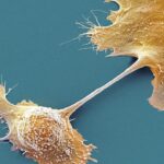 Scientists find promising pancreatic cancer leads